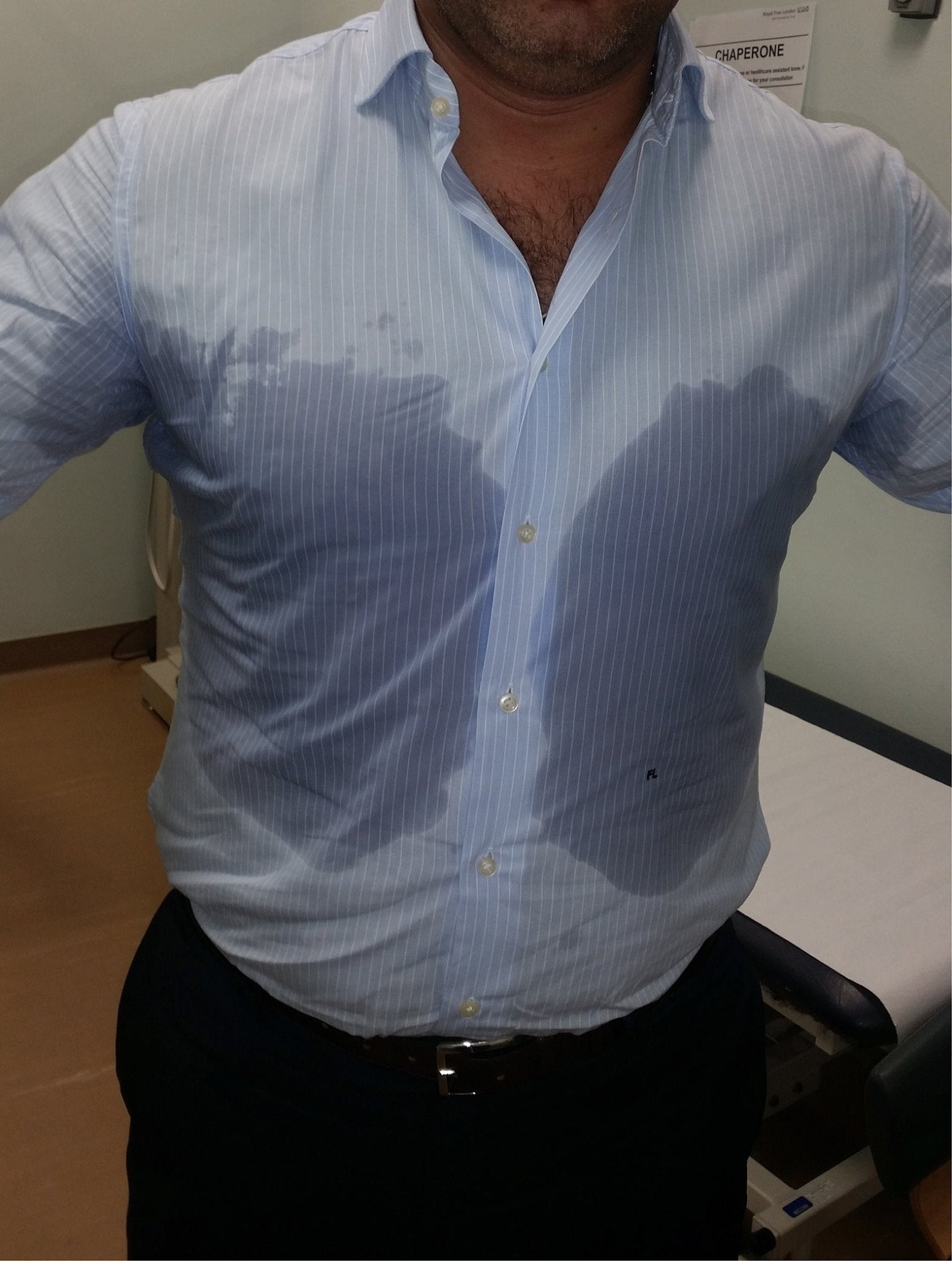 Endoscopic Thoracic Sympathectomy (ETS) - No Sweat Clothing AS